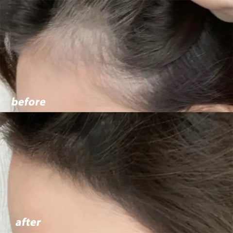 Waterproof Root Cover Up Cushion